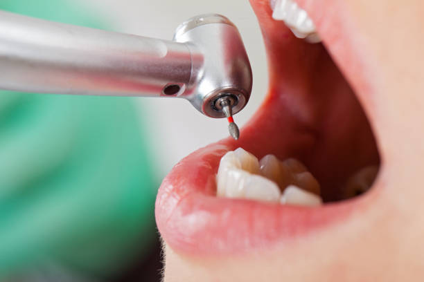Best Emergency Dental Surgery in Bensley, VA